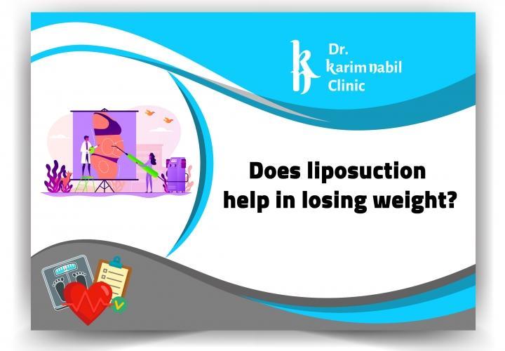 Does liposuction help in losing weight?